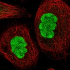 Immunofluorescent staining of human cell line A-431 shows localization to nucleoplasm.