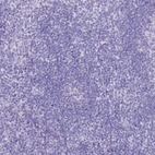 Immunohistochemical staining of human tonsil shows low expression as expected.