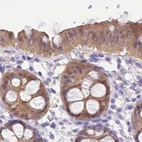 Immunohistochemical staining of human colon using Anti-PBLD antibody HPA038035.