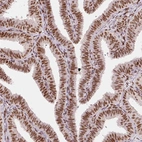 Immunohistochemical staining of human fallopian tube shows strong nuclear positivity in glandular cells.