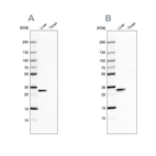 Western blot analysis using Anti-PBLD antibody HPA038035 (A) shows similar pattern to independent antibody HPA038036 (B).