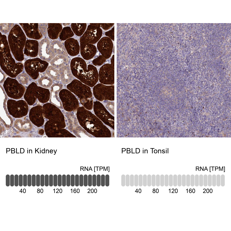 Anti-PBLD Antibody