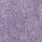 Immunohistochemical staining of human tonsil shows low expression as expected.