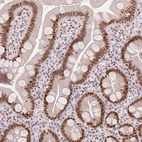Immunohistochemical staining of human small intestine shows moderate to strong nuclear positivity in glandular cells.