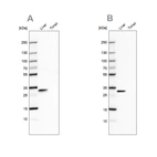 Western blot analysis using Anti-PBLD antibody HPA038036 (A) shows similar pattern to independent antibody HPA038035 (B).
