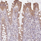 Anti-FAM208B Antibody