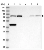 Lane 1: Marker [kDa] 250, 130, 95, 72, 55, 36, 28, 17, 10_br/_Lane 2: Human cell line RT-4_br/_Lane 3: Human cell line U-251 MG_br/_Lane 4: Human plasma_br/_Lane 5: Human Liver tissue_br/_Lane 6: Human Tonsil tissue