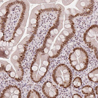Immunohistochemical staining of human small intestine shows moderate to strong nuclear positivity in glandular cells.