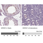 Anti-SPATA7 Antibody