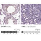 Anti-SPATA7 Antibody