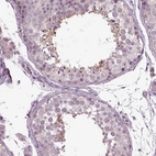 Immunohistochemical staining of human testis shows high expression.