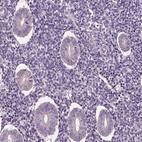 Immunohistochemical staining of human endometrium shows low expression as expected.