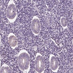 Anti-SPATA7 Antibody