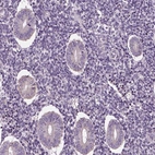 Immunohistochemical staining of human endometrium shows low expression as expected.