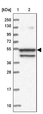Lane 1: Marker [kDa] 250, 130, 95, 72, 55, 36, 28, 17, 10_br/_Lane 2: Human cell line RT-4