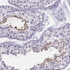 Immunohistochemical staining of human testis shows weak to moderate cytoplasmic positivity in spermatids.