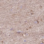 Immunohistochemical staining of human cerebral cortex using Anti-HIP1R antibody HPA038135.