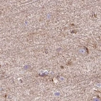 Immunohistochemical staining of human cerebral cortex using Anti-HIP1R antibody HPA038135.
