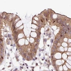 Immunohistochemical staining of human colon using Anti-HIP1R antibody HPA038135.