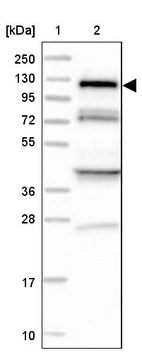 Lane 1: Marker [kDa] 250, 130, 95, 72, 55, 36, 28, 17, 10_br/_Lane 2: Human cell line RT-4