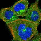 Immunofluorescent staining of human cell line A-431 shows localization to cytosol & vesicles.