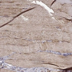 Immunohistochemical staining of human skeletal muscle shows strong cytoplasmic positivity in myocytes.