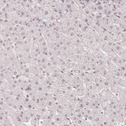 Immunohistochemical staining of human liver shows no nuclear positivity in hepatocytes as expected.