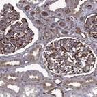 Immunohistochemical staining of human kidney shows strong cytoplasmic positivity in cells in glomeruli.