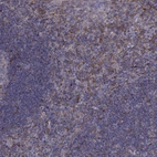 Immunohistochemical staining of human tonsil shows strong cytoplasmic positivity in non-germinal center cells.