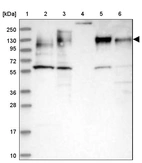 Lane 1: Marker [kDa] 250, 130, 95, 72, 55, 36, 28, 17, 10_br/_Lane 2: Human cell line RT-4_br/_Lane 3: Human cell line U-251MG sp_br/_Lane 4: Human plasma (IgG/HSA depleted)_br/_Lane 5: Human liver tissue_br/_Lane 6: Human tonsil tissue