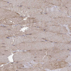 Immunohistochemical staining of human skeletal muscle shows strong cytoplasmic positivity in myocytes.