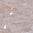 Immunohistochemical staining of human skeletal muscle shows strong cytoplasmic positivity in myocytes.