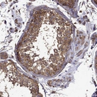 Immunohistochemical staining of human testis shows strong cytoplasmic positivity in cells in seminiferous ducts.