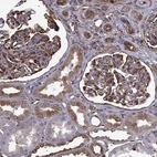 Immunohistochemical staining of human kidney shows strong cytoplasmic positivity in cells in glomeruli.