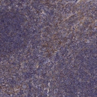 Immunohistochemical staining of human tonsil shows strong cytoplasmic positivity in non-germinal center cells.