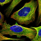 Immunofluorescent staining of human cell line U-2 OS shows localization to plasma membrane, cytosol & microtubules.