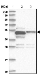 Lane 1: Marker [kDa] 250, 130, 95, 72, 55, 36, 28, 17, 10_br/_Lane 2: Human cell line RT-4_br/_Lane 3: Human cell line U-251MG sp