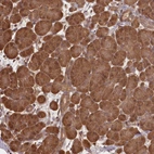 Anti-NPRL2 Antibody