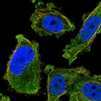 Immunofluorescent staining of human cell line PC-3 shows localization to cytosol & microtubules.