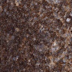 Immunohistochemical staining of human lymph node using Anti-VPS37B antibody HPA038218.