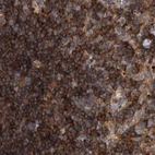 Immunohistochemical staining of human lymph node using Anti-VPS37B antibody HPA038218.