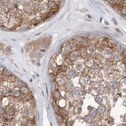 Immunohistochemical staining of human testis using Anti-VPS37B antibody HPA038218.