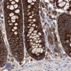 Immunohistochemical staining of human colon using Anti-VPS37B antibody HPA038218.