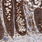 Immunohistochemical staining of human colon using Anti-VPS37B antibody HPA038218.