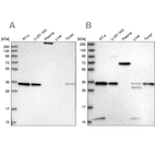 Western blot analysis using Anti-VPS37B antibody HPA038218 (A) shows similar pattern to independent antibody HPA038217 (B).