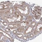 Immunohistochemical staining of human kidney shows weak to moderate positivity in luminal membrane in cells in tubules.
