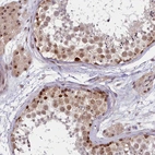 Anti-TCOF1 Antibody