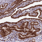 Immunohistochemical staining of human Fallopian tube shows strong nuclear positivity in glandular cells.