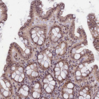 Immunohistochemical staining of human colon shows weak to moderate nuclear and nucleolar positivity in glandular cells.