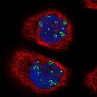 Immunofluorescent staining of human cell line A-431 shows localization to nucleoli fibrillar center.